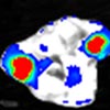 Suppressing cancer metastasis